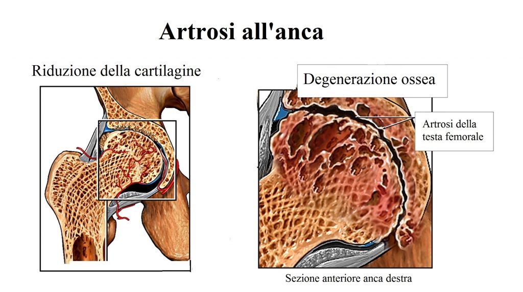 anca3